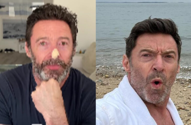 Cáncer de piel acecha a Hugh Jackman