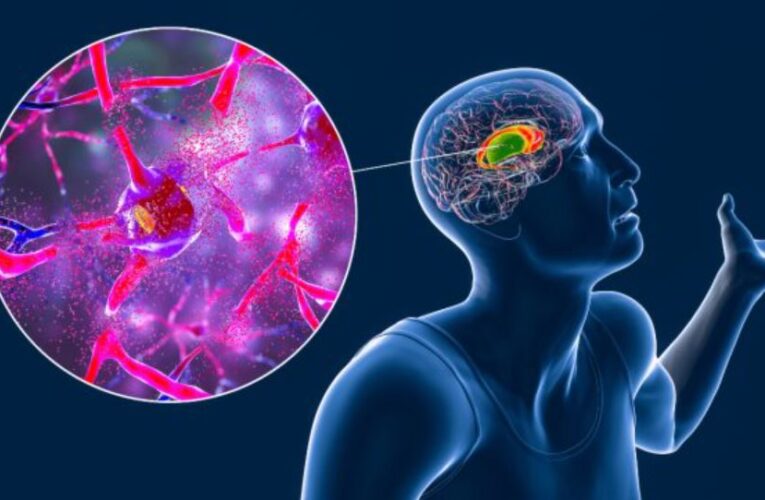 Investigadores ingleses desarrollan nueva inyección para la enfermedad de Huntington