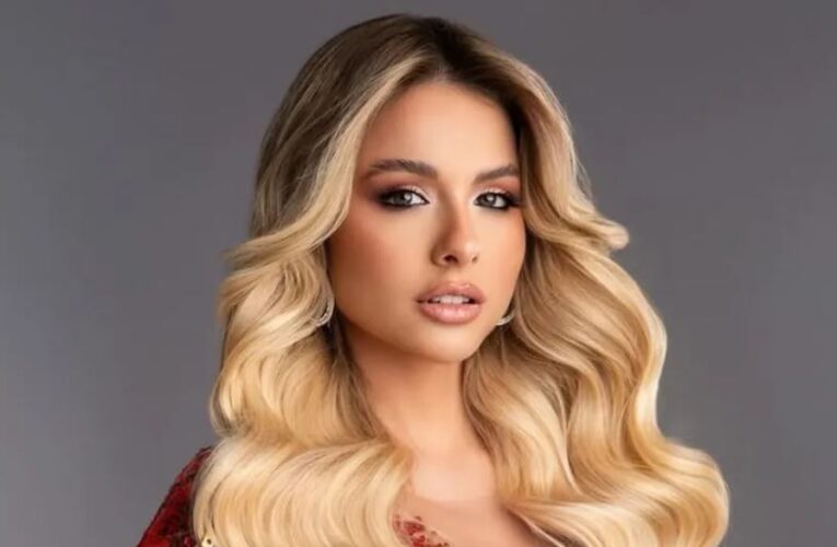 Miss Universo Argentina tiene alopecia; muestra la zona donde no le crece cabello: «Todos tenemos imperfecciones»