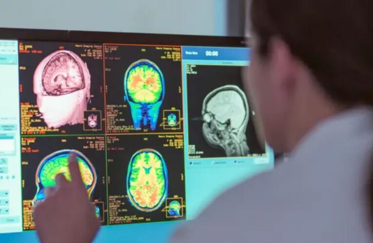 La adolescencia dura hasta los 32 años, según un nuevo estudio