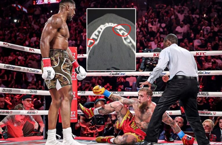 Jake Paul termina con doble mandíbula rota y desafía a Canelo ¡en 10 días!