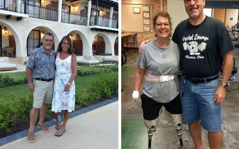 Mujer pierde brazos y piernas tras infección causada por su perro: “fue el peor día de mi vida”